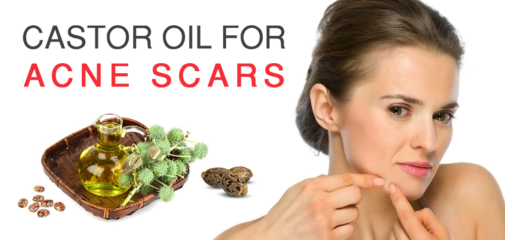 Top Benefits of Castor Oil for Skin